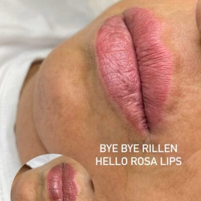 „Rillenfrei. Rosig. Regeneriert.“ Mit der Lumi Lips Behandlung bei Mel’s Beauty.