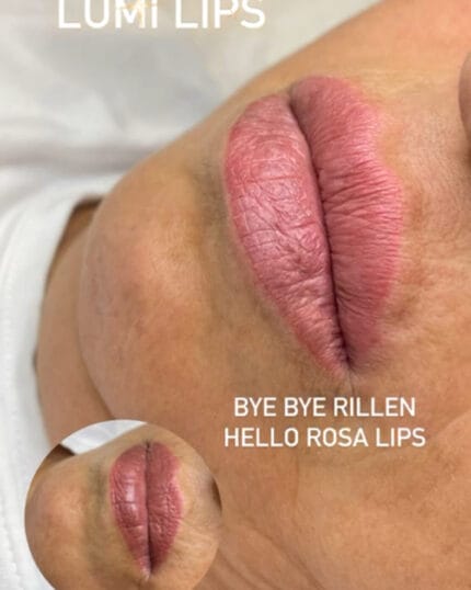 „Rillenfrei. Rosig. Regeneriert.“ Mit der Lumi Lips Behandlung bei Mel’s Beauty.