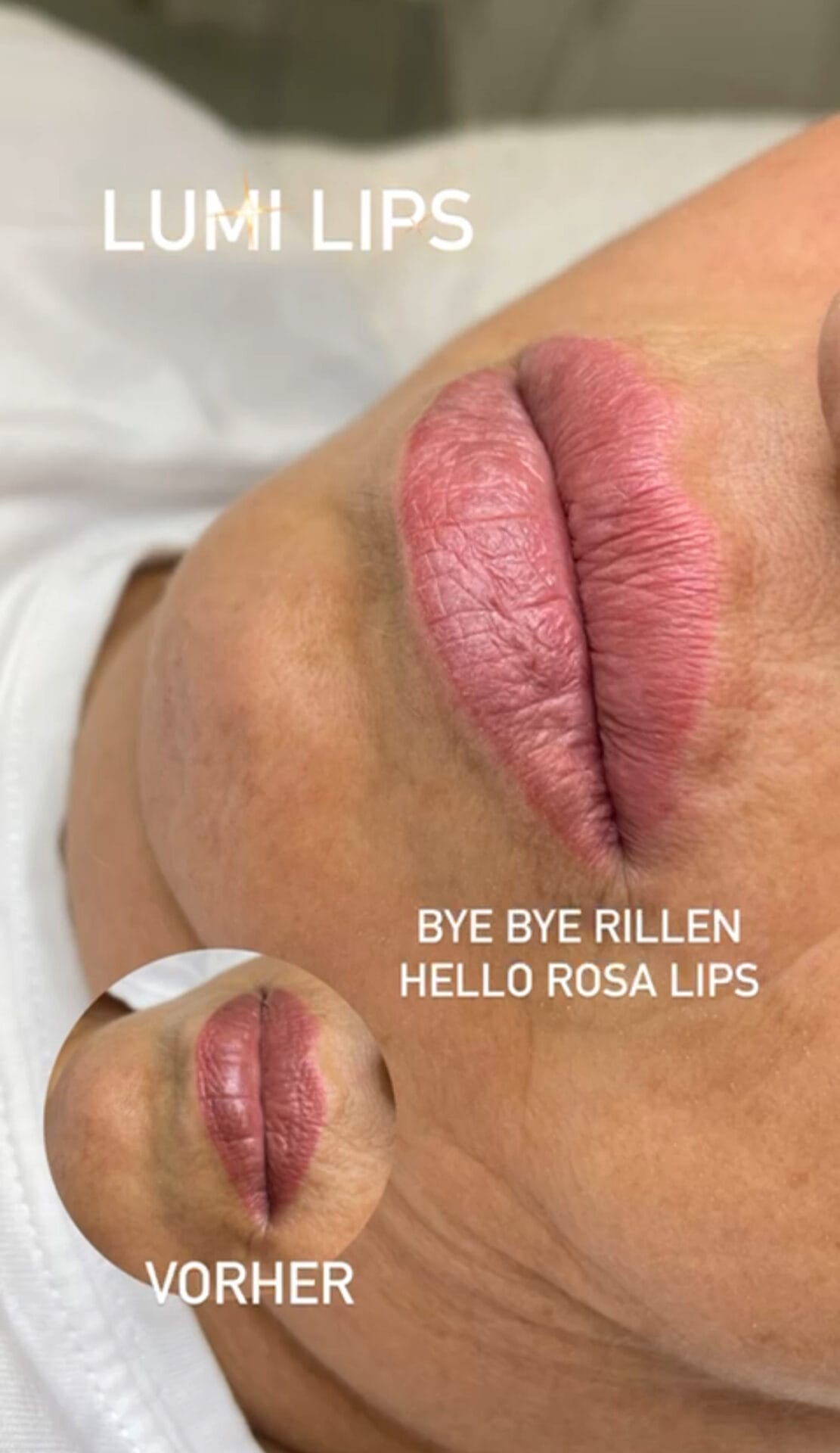 „Rillenfrei. Rosig. Regeneriert.“ Mit der Lumi Lips Behandlung bei Mel’s Beauty.